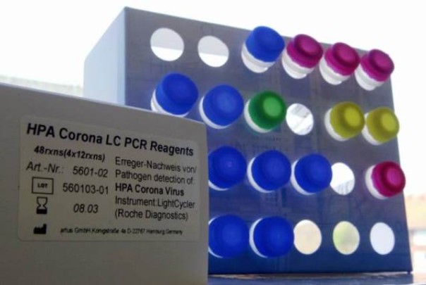 Un kit per diagnosticare il Coronavirus (Nuova Sars)