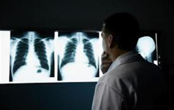 Tumore al polmone, è la prima causa di morte per cancro