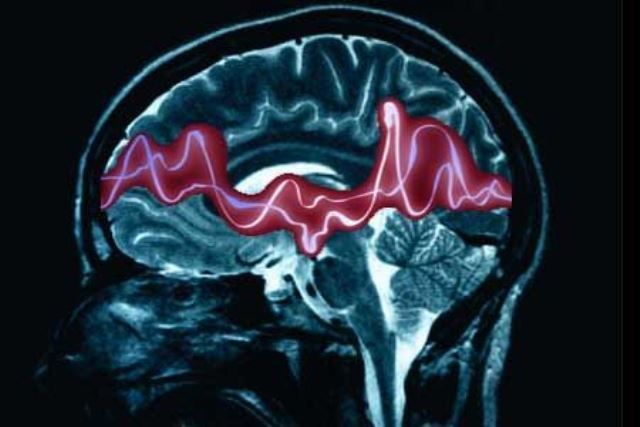 Identificato il gene di una forma di epilessia