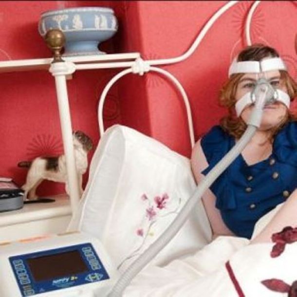 Sindrome Ondine, malattia rara, durante il sonno si smette di respirare